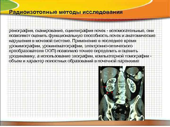 Радиоизотопные методы исследования ренография, сканирование, сцинтиграфия почек - вспомогательные, они позволяют оценить функциональную способность