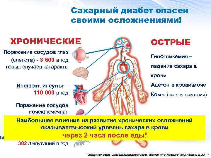 Энцефалопатия на фоне сахарного диабета