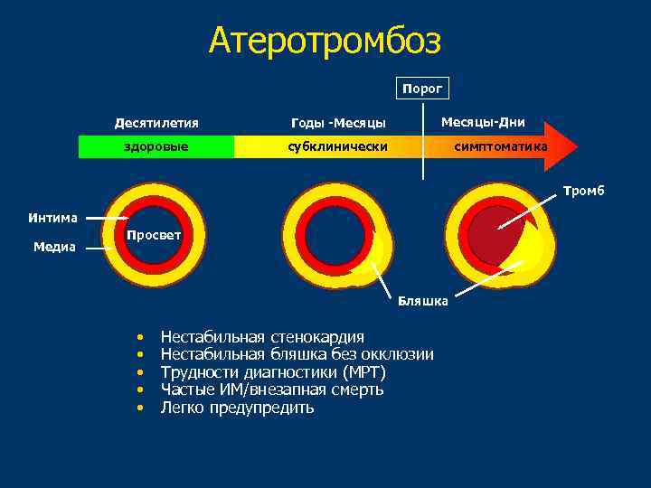 Атеротромбоз Порог Десятилетия здоровые Месяцы-Дни Годы -Месяцы субклинически симптоматика Tромб Интима Meдиа Просвет Бляшка