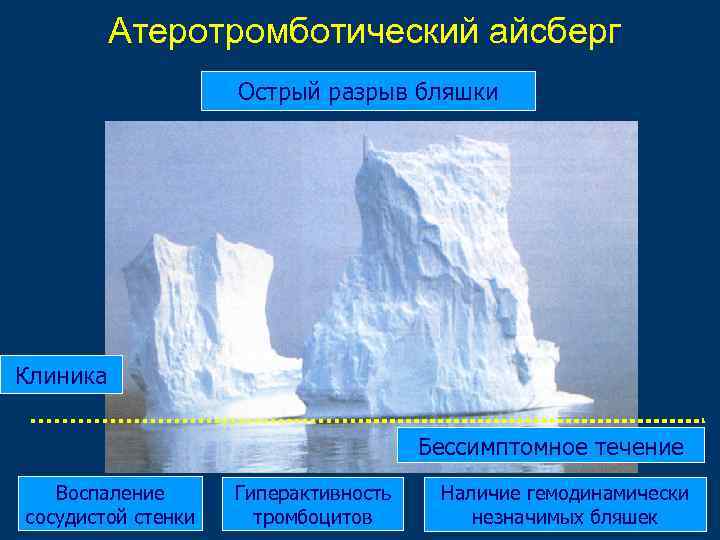 Атеротромботический айсберг Острый разрыв бляшки Клиника Бессимптомное течение Воспаление сосудистой стенки Гиперактивность тромбоцитов Наличие