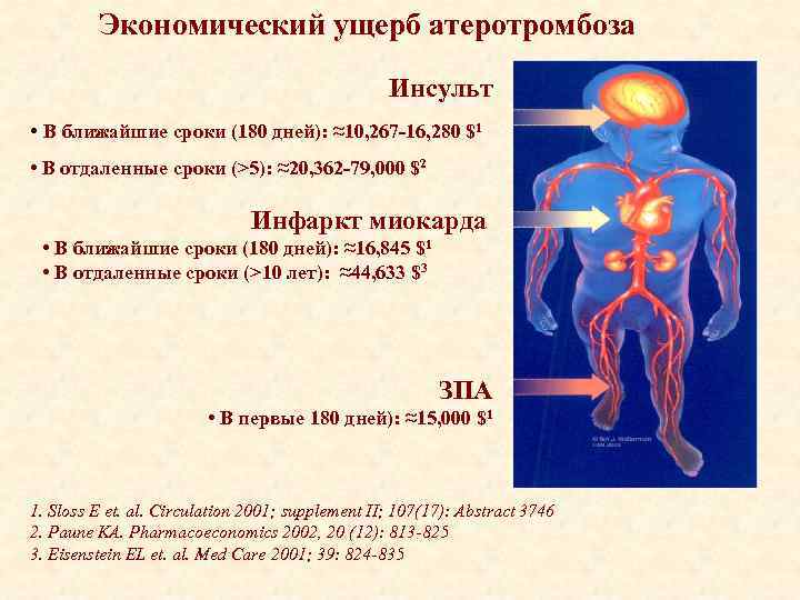 Экономический ущерб атеротромбоза Инсульт • В ближайшие сроки (180 дней): ≈10, 267 -16, 280