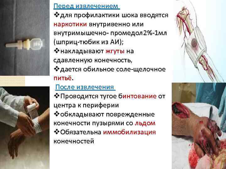 Перед извлечением vдля профилактики шока вводятся наркотики внутривенно или внутримышечно- промедол 2%-1 мл (шприц-тюбик