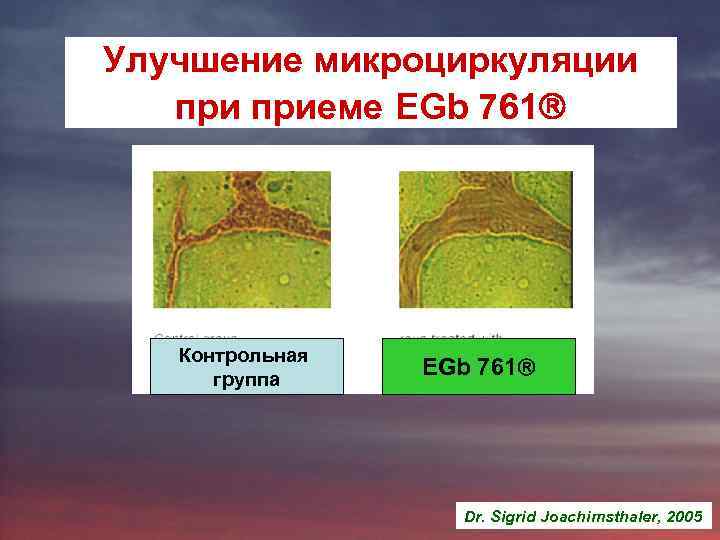 Улучшение микроциркуляции приеме EGb 761 Контрольная группа EGb 761 Dr. Sigrid Joachimsthaler, 2005 
