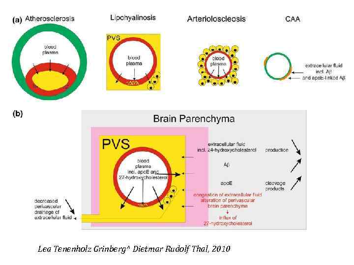  Lea Tenenholz Grinberg^ Dietmar Rudolf Thal, 2010 