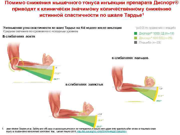 Помимо снижения мышечного тонуса инъекции препарата Диспорт® приводят к клинически значимому количественному снижению истинной