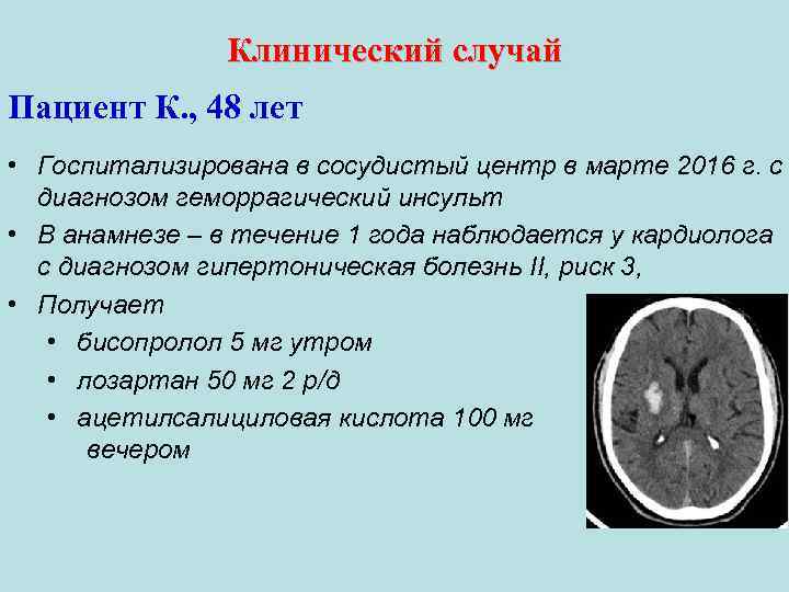 Клинический случай Пациент К. , 48 лет • Госпитализирована в сосудистый центр в марте