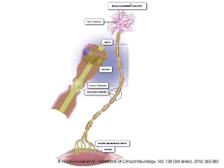 R. Hanewinckel et al. , Handbook of Clinical Neurology, Vol. 138 (3 rd series),