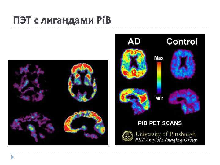 ПЭТ с лигандами Pi. B 