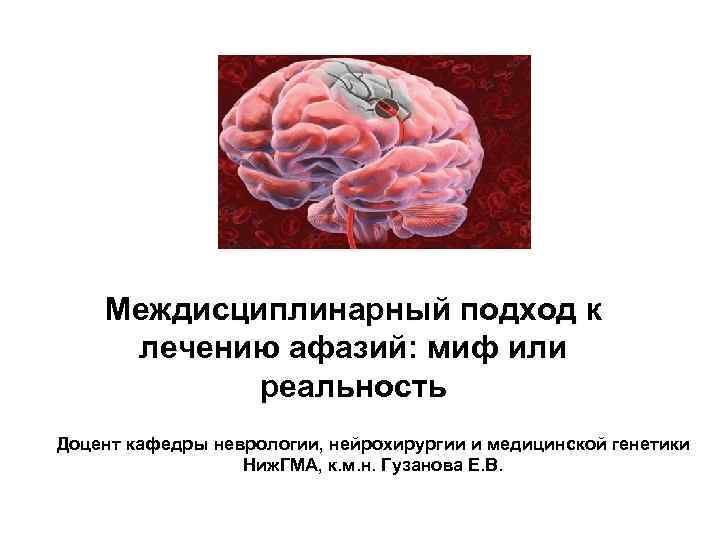 Междисциплинарный подход к лечению афазий: миф или реальность Доцент кафедры неврологии, нейрохирургии и медицинской