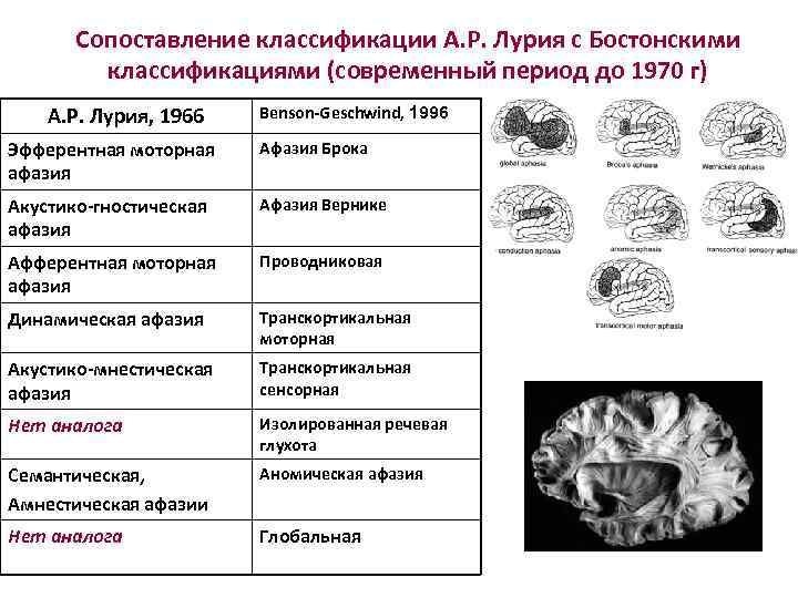 Сопоставление классификации А. Р. Лурия с Бостонскими классификациями (современный период до 1970 г) А.