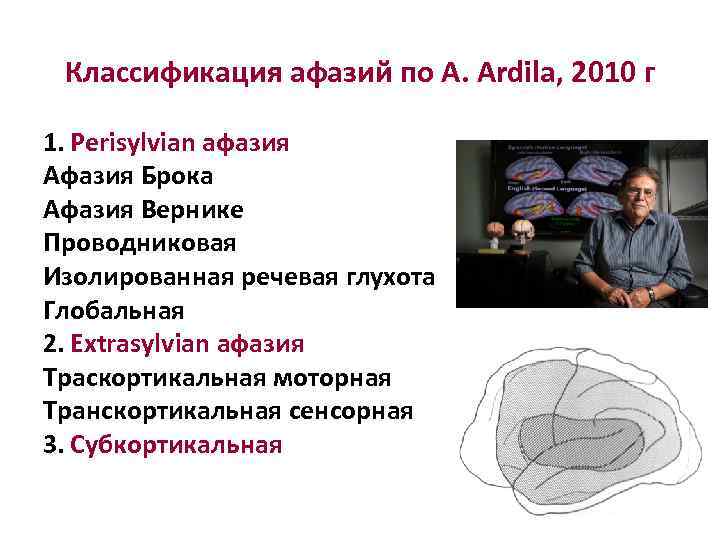 Классификация афазий по A. Ardila, 2010 г 1. Perisylvian афазия Афазия Брока Афазия Вернике