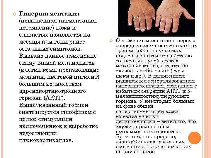  Гиперпигментация (повышенная пигментация, потемнение) кожи и слизистых появляется на месяцы или годы ранее