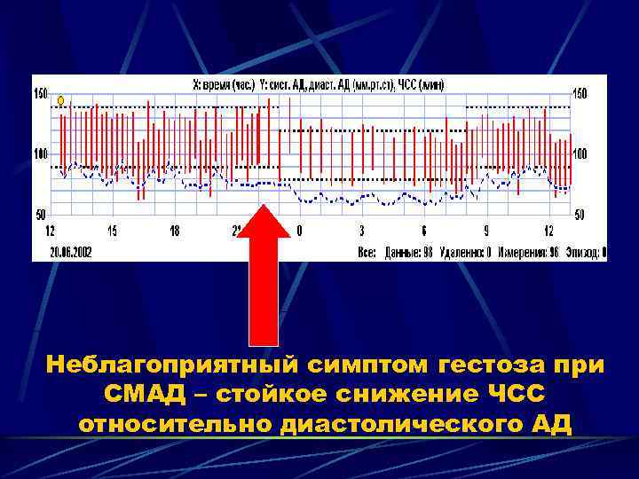 Неблагоприятный симптом гестоза при СМАД – стойкое снижение ЧСС относительно диастолического АД 