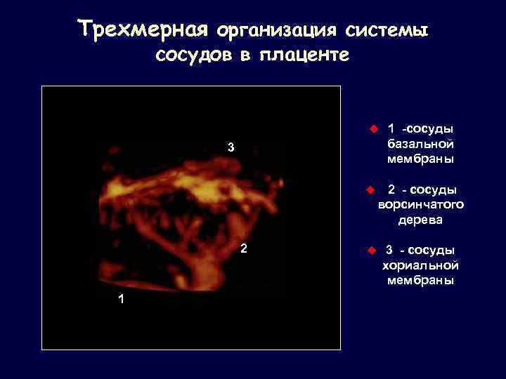 Трехмерная организация системы сосудов в плаценте u 3 u 2 1 1 -сосуды базальной