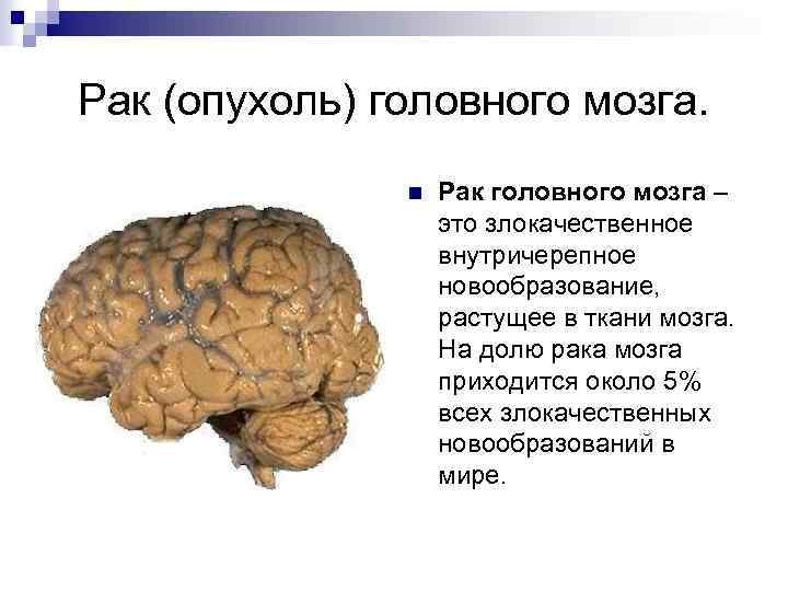 Рак (опухоль) головного мозга. n Рак головного мозга – это злокачественное внутричерепное новообразование, растущее