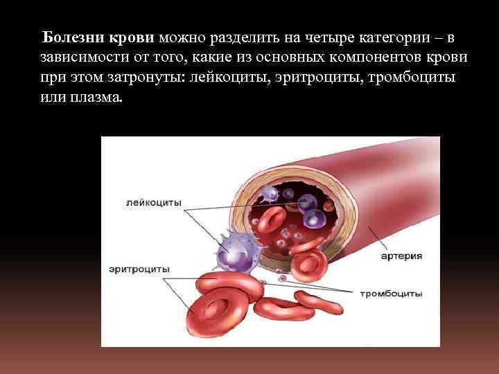 Болезни крови картинки