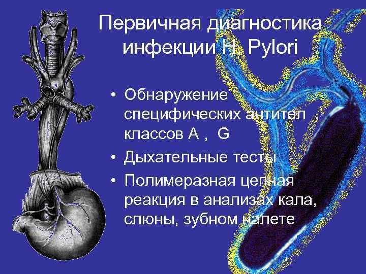 Первичная диагностика инфекции H. Pylori • Обнаружение специфических антител классов A , G •