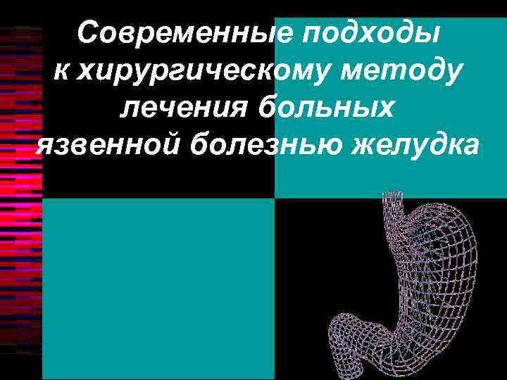Современные подходы к хирургическому методу лечения больных язвенной болезнью желудка 