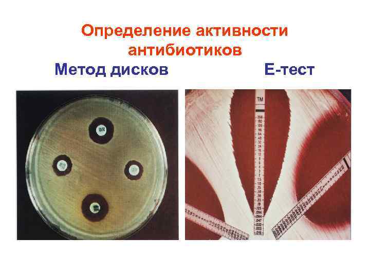 Определение активности антибиотиков Метод дисков Е-тест 