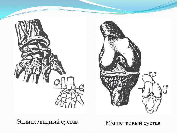 Эллипсовидный сустав Мыщелковый сустав 