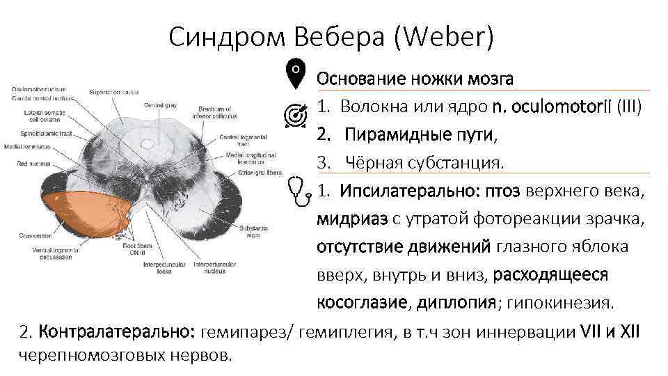 Основание ножки мозга