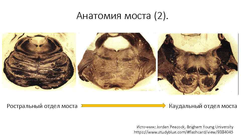 Анатомия моста (2). Ростральный отдел моста Каудальный отдел моста Источник: Jordan Peacock, Brigham Young
