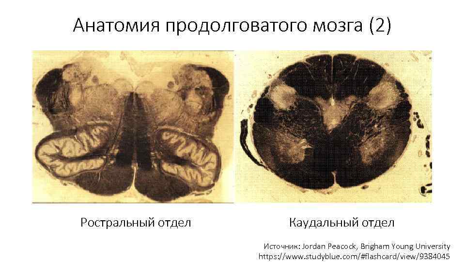 Анатомия продолговатого мозга (2) Ростральный отдел Каудальный отдел Источник: Jordan Peacock, Brigham Young University