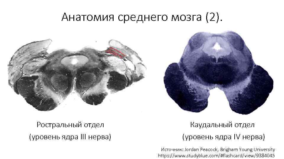 Анатомия среднего мозга (2). Ростральный отдел Каудальный отдел (уровень ядра III нерва) (уровень ядра