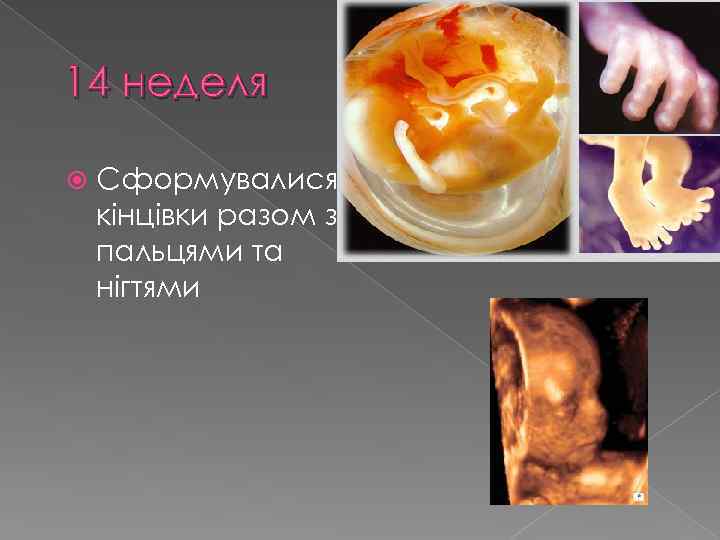 14 неделя Сформувалися кінцівки разом з пальцями та нігтями 