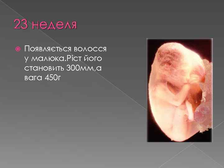 23 неделя Появляється волосся у малюка. Ріст його становить 300 мм, а вага 450