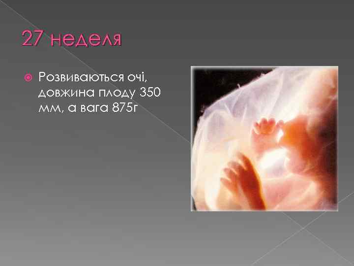 27 неделя Розвиваються очі, довжина плоду 350 мм, а вага 875 г 
