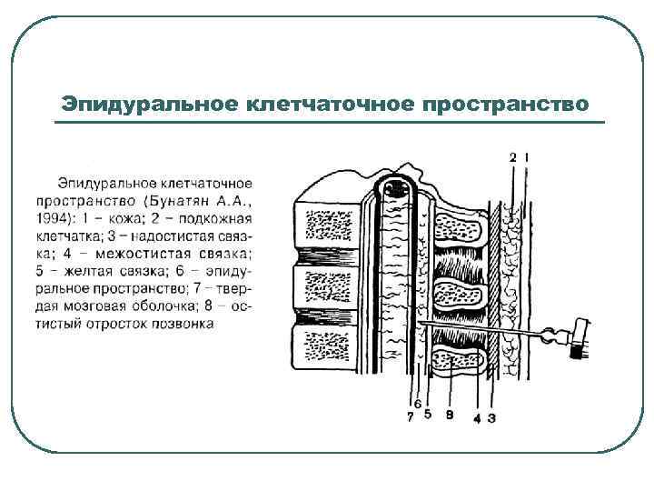 Эпидуральное клетчаточное пространство 