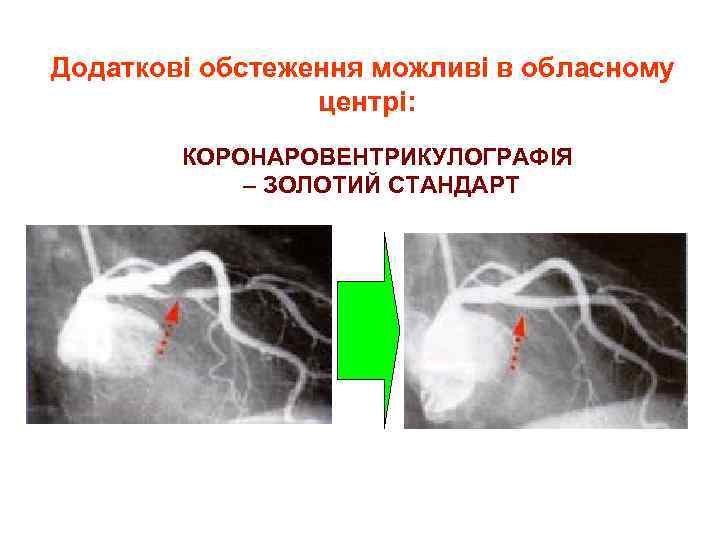 Додаткові обстеження можливі в обласному центрі: КОРОНАРОВЕНТРИКУЛОГРАФІЯ – ЗОЛОТИЙ СТАНДАРТ 