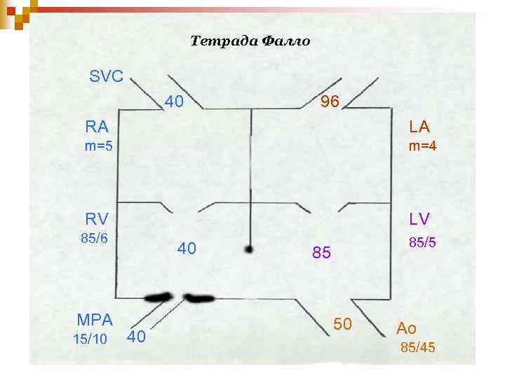 Тетрада Фалло SVC 40 96 RA LA m=5 m=4 RV LV 85/6 MPA 15/10