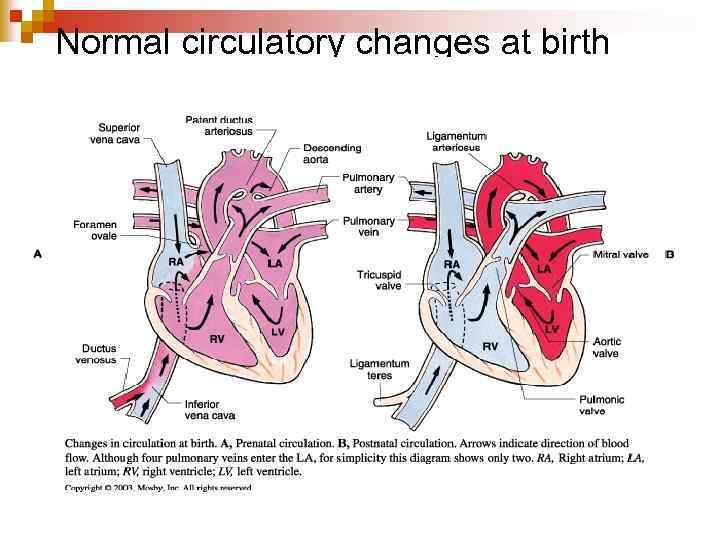 Normal circulatory changes at birth 