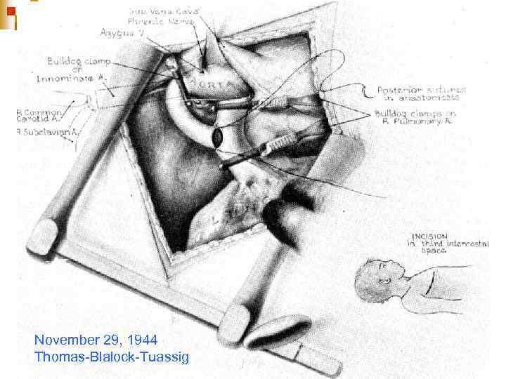 November 29, 1944 Thomas-Blalock-Tuassig 