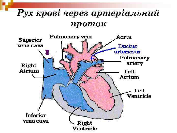 Рух крові через артеріальний проток 