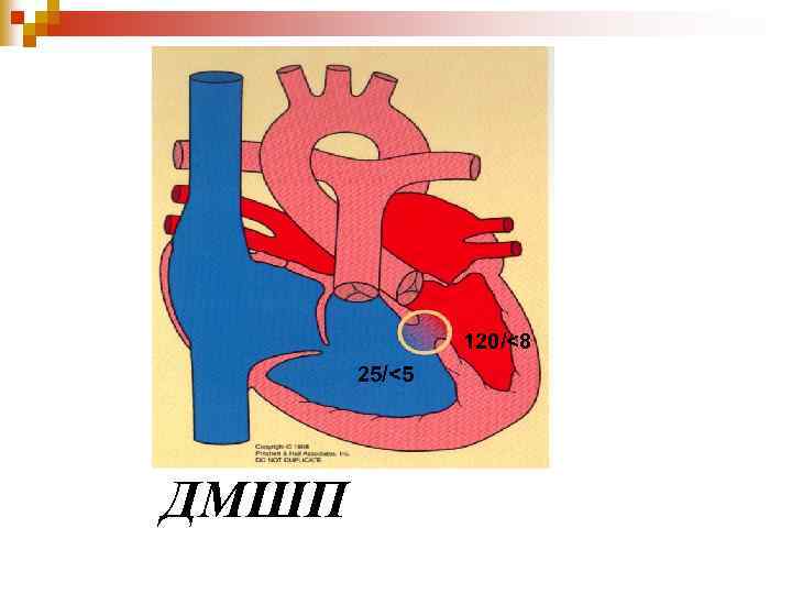 120/<8 25/<5 ДМШП 