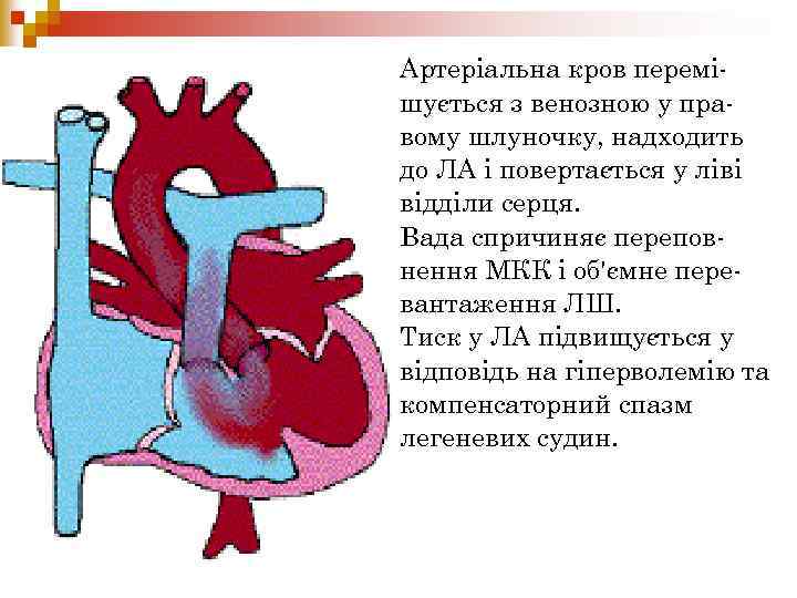 Артеріальна кров перемішується з венозною у правому шлуночку, надходить до ЛА і повертається у