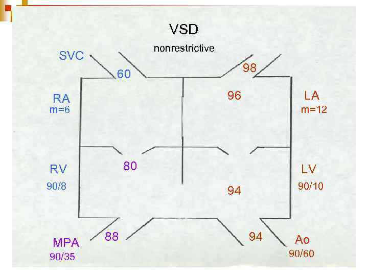VSD nonrestrictive SVC 98 60 96 RA LA m=6 m=12 80 RV 90/8 MPA