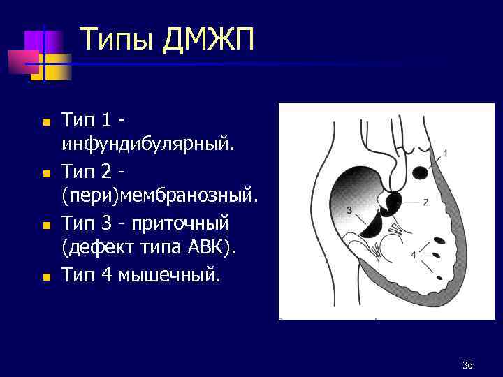 Типы ДМЖП n n Тип 1 инфундибулярный. Тип 2 (пери)мембранозный. Тип 3 - приточный