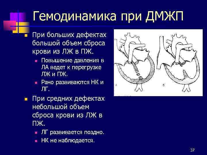 Гемодинамика при ДМЖП n При больших дефектах большой объем сброса крови из ЛЖ в