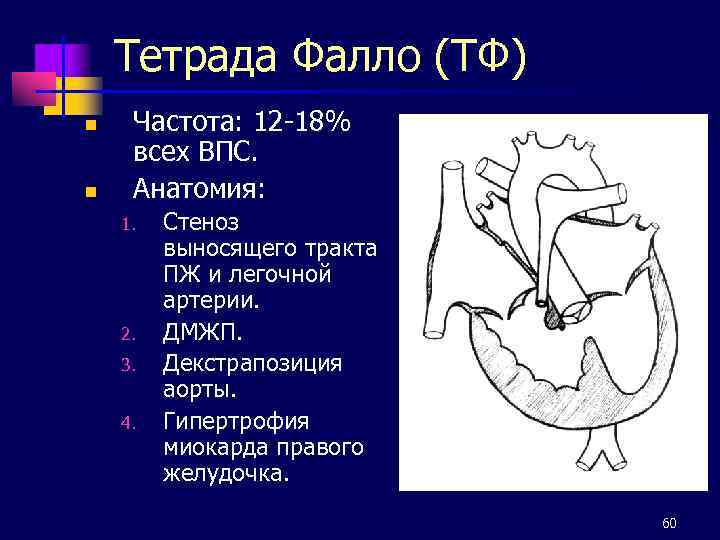 Тетрада Фалло (ТФ) n n Частота: 12 -18% всех ВПС. Анатомия: 1. 2. 3.