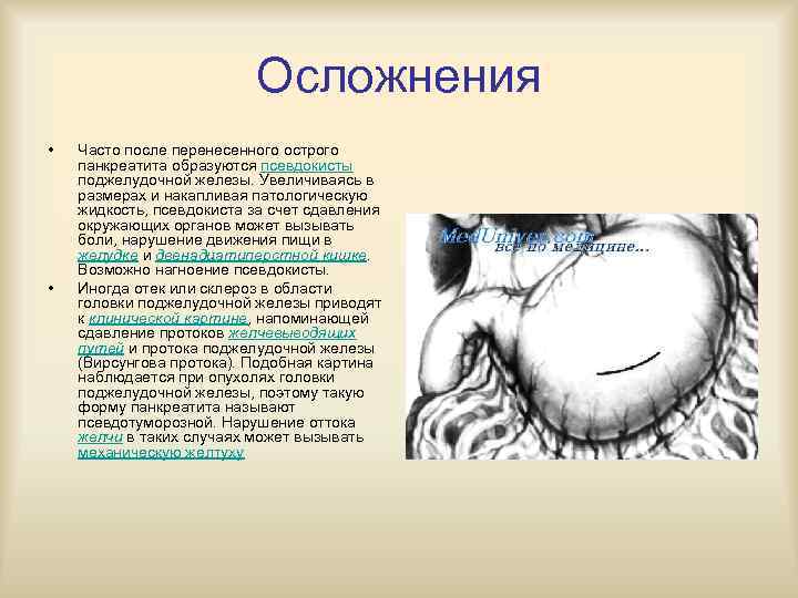 Схема лечения острого панкреатита