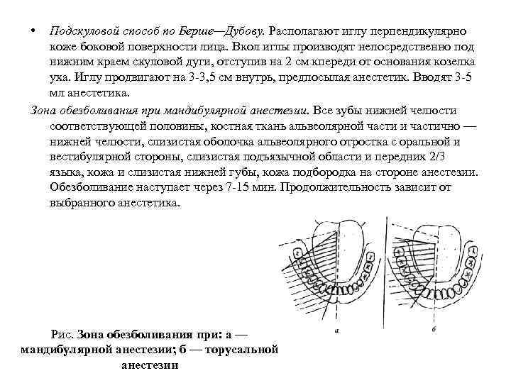  • Подскуловой способ по Берше—Дубову. Располагают иглу перпендикулярно коже боковой поверхности лица. Вкол