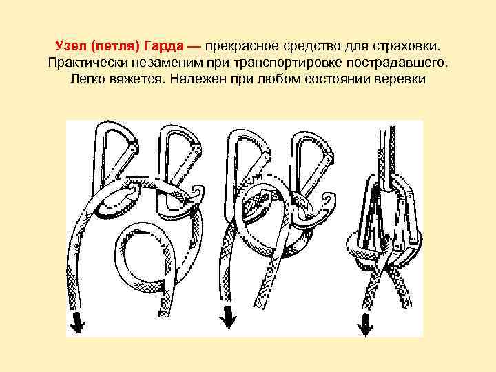 Кастрационная петля схема