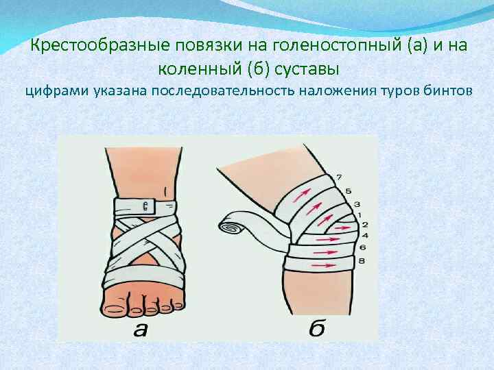 Как перевязывать бинтом