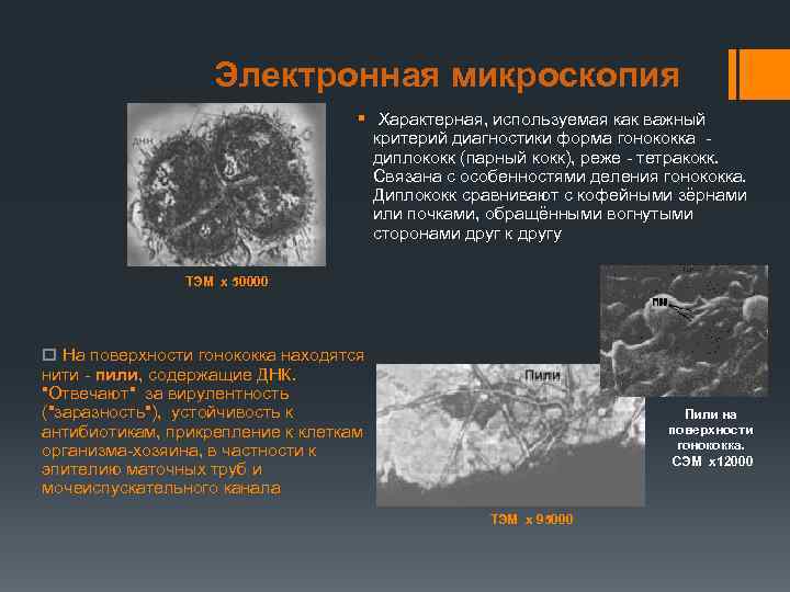Электронная микроскопия § Характерная, используемая как важный критерий диагностики форма гонококка - диплококк (парный