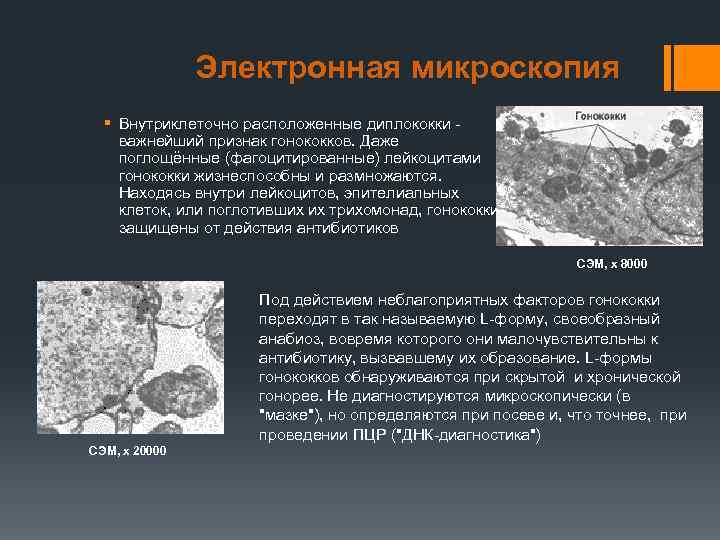 Электронная микроскопия § Внутриклеточно расположенные диплококки - важнейший признак гонококков. Даже поглощённые (фагоцитированные) лейкоцитами