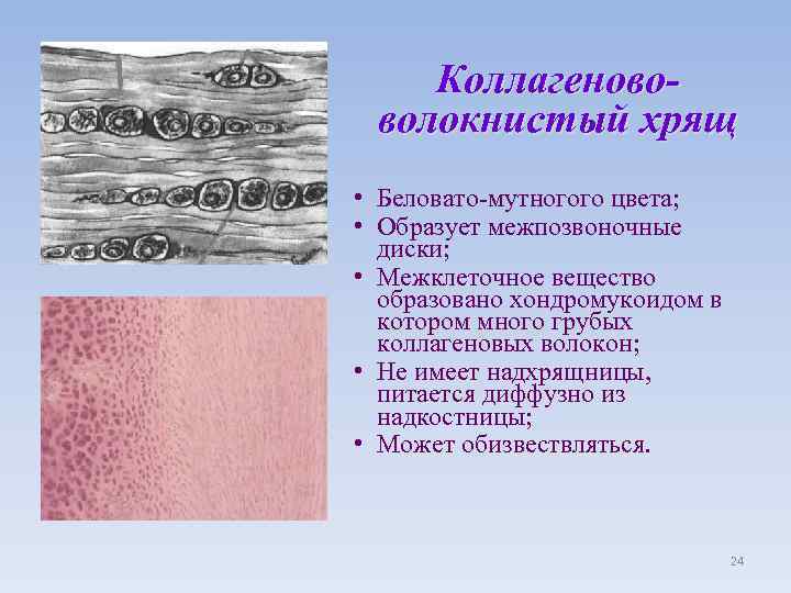 Коллагенововолокнистый хрящ • Беловато-мутногого цвета; • Образует межпозвоночные диски; • Межклеточное вещество образовано хондромукоидом